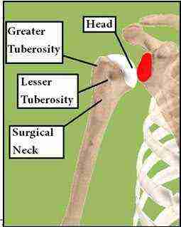 Proximal Humerus: Head, Greater Tuberosity, Lesser Tuberosity, Surgical Neck